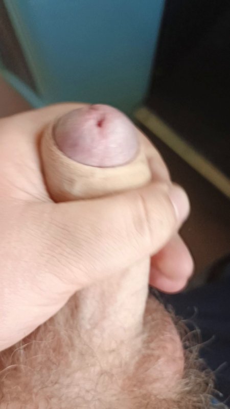 age adults start loosing teeth — Blue Eye Dream Free Onlyfans Nude Leaked Pictures - 8:45